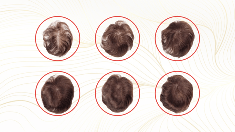 Hair Density For Your Hair System