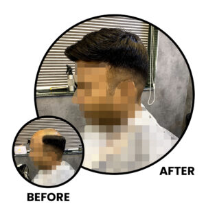 Before and After Non-Surgical Hair Replacement​