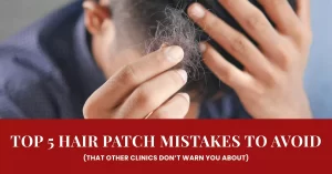 Top 5 Hair Patch Mistakes to Avoid